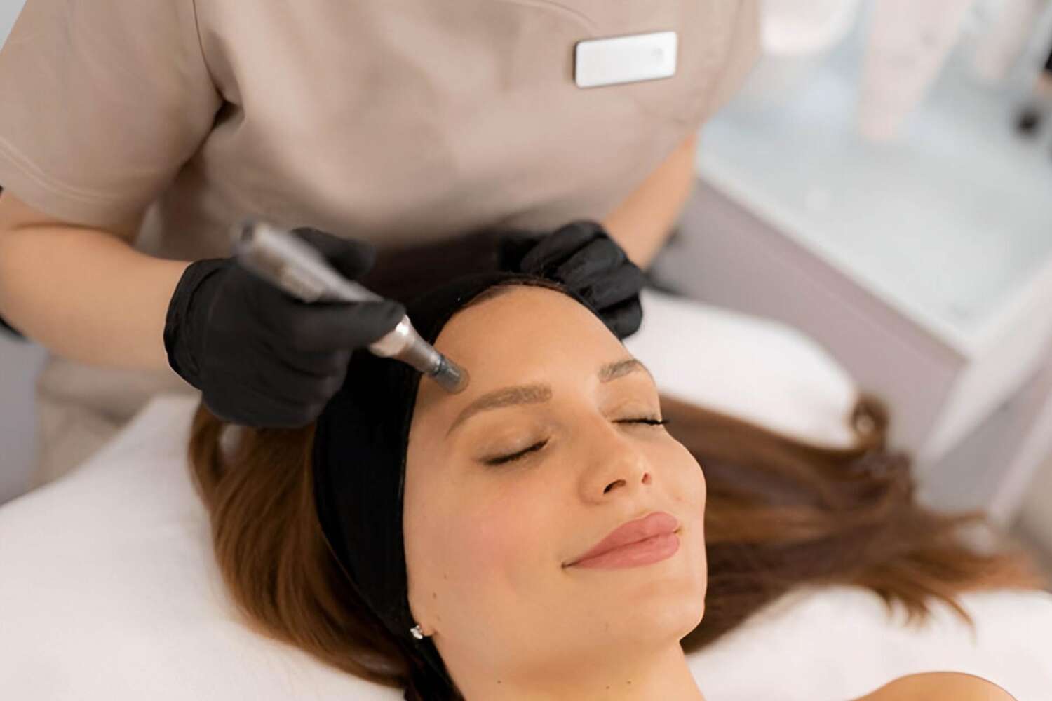 microneedling milano